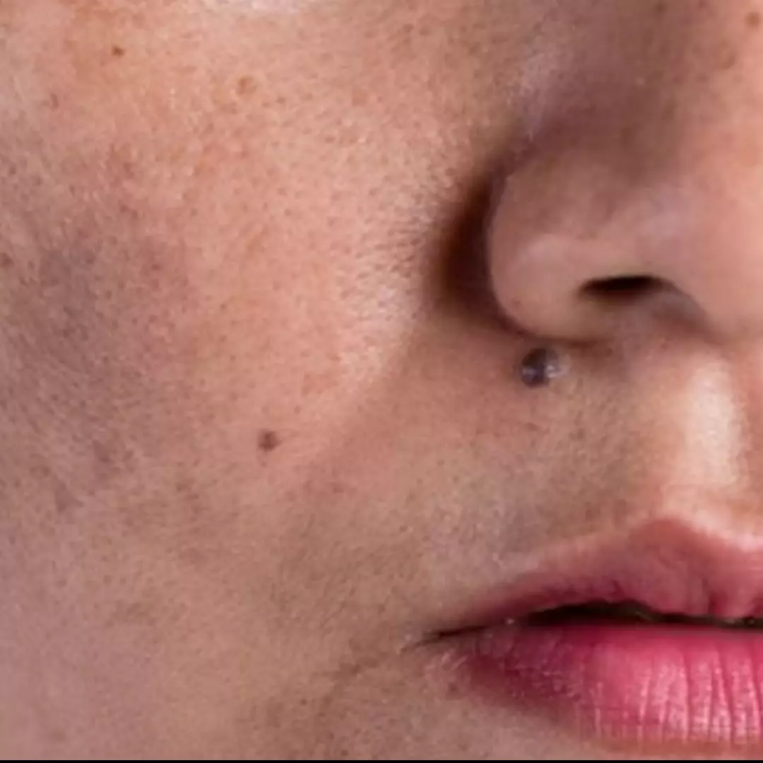 Bukan dengan kopi dan lemon, ini trik pudarkan flek hitam akibat hiperpigmentasi pakai 1 jenis rempah