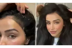 Bukan pakai cuka apel dan lemon, ini cara hempaskan ketombe berkerak pakai 1 jenis daun penyedap