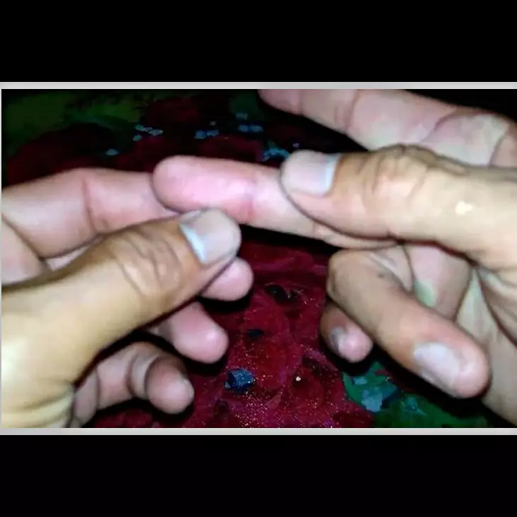 Bukan pakai jarum, begini cara ampuh mengeluarkan duri ikan di tangan cuma pakai 1 bahan dapur