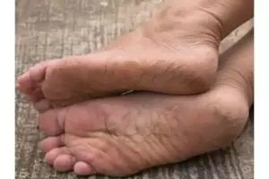 Bukan dengan wax, ini trik haluskan tumit kaki yang retak menghitam pakai 1 jenis minyak