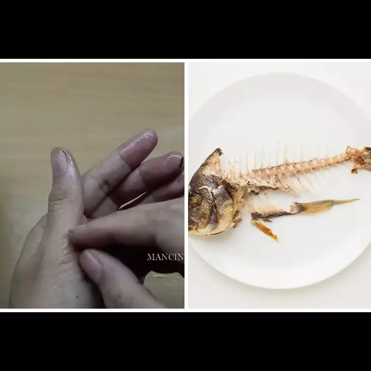 Cukup pakai 2 bahan dapur, begini cara mengobati luka akibat tertusuk duri atau terkena patil ikan