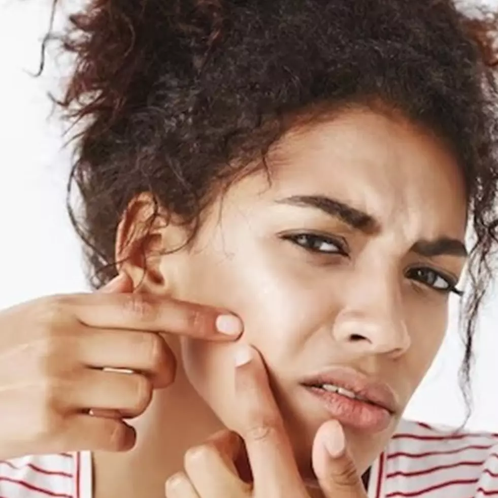 Tanpa perlu pakai krim dokter, ini cara mencerahkan kulit kusam hanya pakai 2 bahan alami