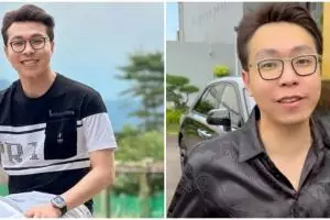 Wajah aslinya yang tak mulus tuai cibiran, intip 11 potret transformasi Richard Lee