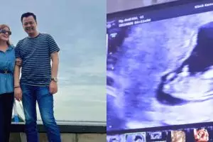 9 Momen bahagia Kiki Amalia umumkan hamil anak pertama di usia 41 tahun, pamer hasil USG bayi