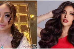 Permak wajah sampai 4 kali oplas hidung, intip 11 potret dulu dan kini Millen Cyrus