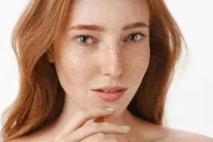 Bukan dengan kunyit dan air mawar, ini trik pudarkan flek hitam membandel pakai 1 jenis buah-buahan