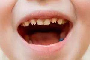 Tak perlu cairan pemutih, ini trik bikin gigi putih dan nggak gampang patah pakai 1 jenis sayuran