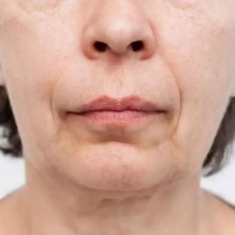 Tak pakai putih telur, ini trik kencangkan wajah kendur agar kembali muda dengan 1 jenis daun penyedap