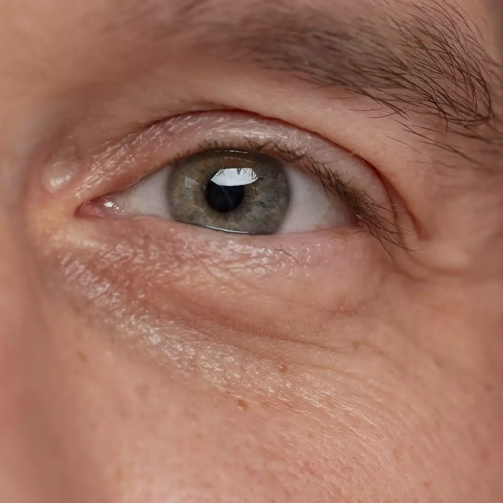 Tanpa masker putih telur, ini cara kencangkan kulit area mata hanya pakai 2 bahan tambahan sayuran