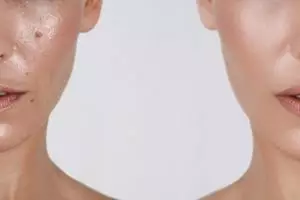 Tanpa aloe vera, ini trik bikin pori-pori bebas minyak berlebih pakai toner dari 1 jenis sayuran