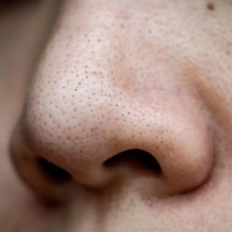 Bukan dengan madu, ini trik kecilkan pori-pori agar kulit tak terasa kasar pakai 2 jenis minuman