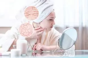 Tak perlu madu, ini trik bikin kulit kering bebas rasa ketarik pakai face mist dari 1 jenis sayuran