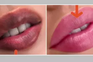 Tak perlu sulam, ini cara mengatasi bibir menghitam agar kembali merah alami pakai 1 jenis umbi-umbian