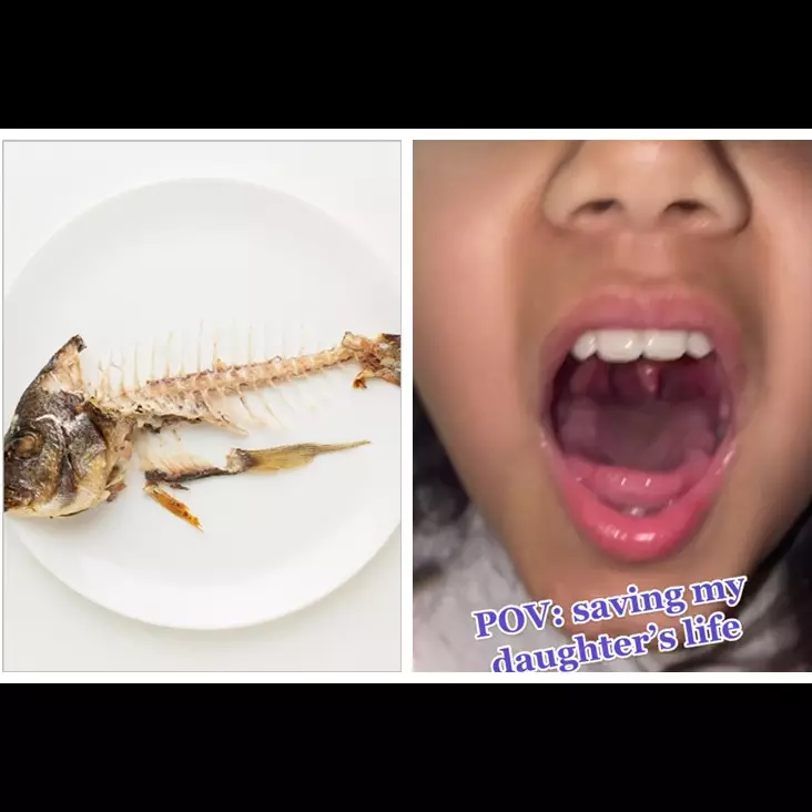 Bukan menelan nasi, aksi wanita mengeluarkan duri ikan di tenggorokan ini ampuhnya bikin melongo