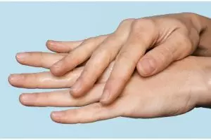 Bukan dengan air beras, ini cara ratakan kulit tangan belang hanya pakai 1 bahan makanan