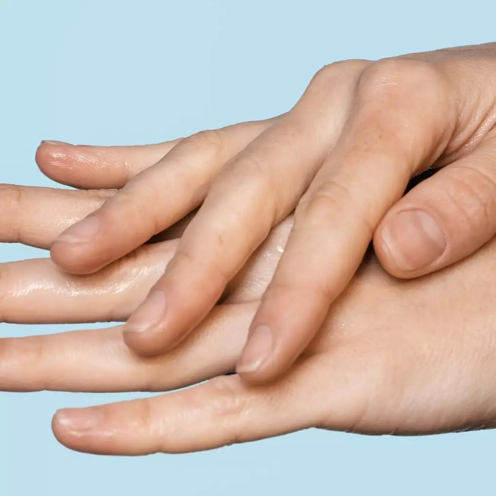 Bukan dengan air beras, ini cara ratakan kulit tangan belang hanya pakai 1 bahan makanan