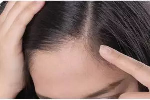 Tak perlu dicukur, ini trik hilangkan anak rambut di sekitar dahi hanya pakai 1 bahan minuman