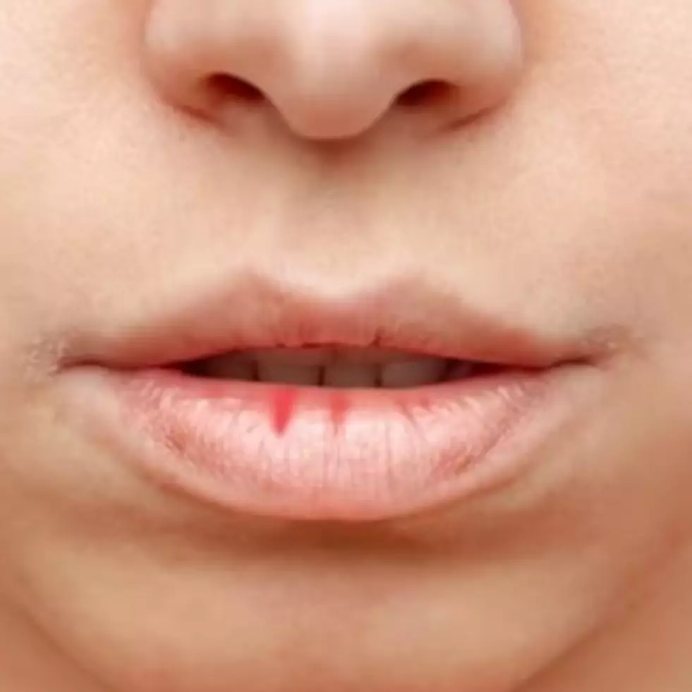 Bukan dengan madu, ini cara lembutkan bibir retak mengelupas dan hitam pakai 1 jenis produk pelembap