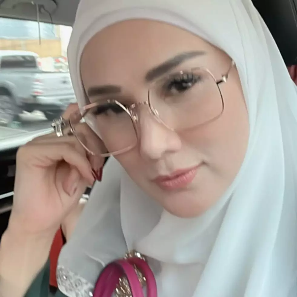 Perubahan hidungnya tuai sorotan, ini 11 potret Mulan Jameela dulu &amp; kini yang bantah operasi plastik