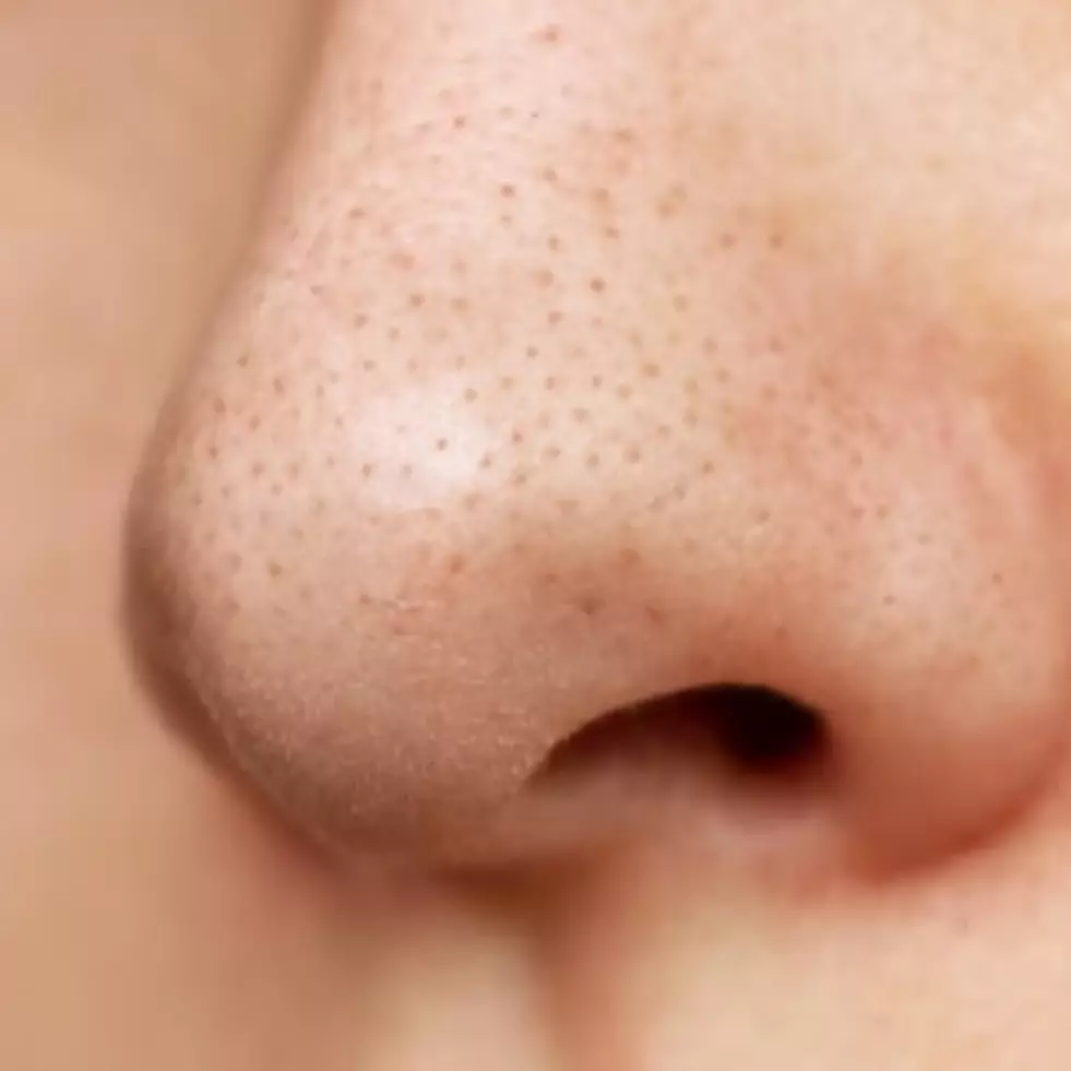 Nggak cukup cuci muka, ini cara membersihkan kulit dari komedo pakai tambahan 1 ekstrak daun