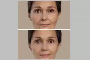 Bukan hanya mentimun, begini trik kembalikan kulit kencang pakai 1 bahan minuman