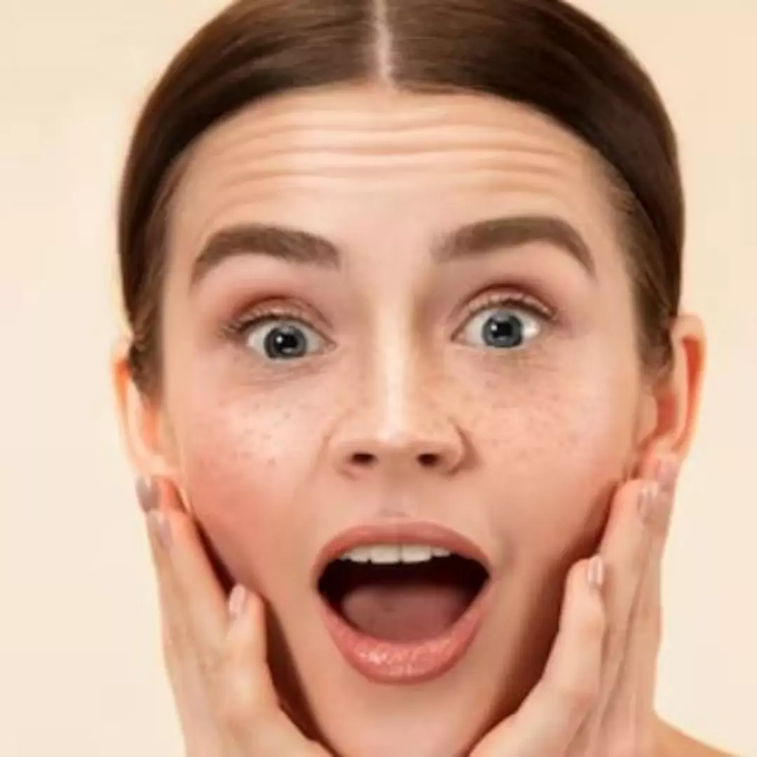 Nggak perlu tambahan kunyit, ini trik hilangkan flek hitam pada wajah pakai 1 jenis produk pelembap