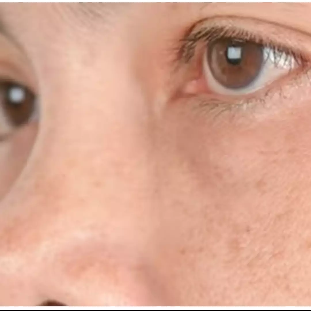 Hasilnya terlihat kurang dari seminggu, ini cara cerahkan pigmentasi pada wajah pakai 1 bahan makanan