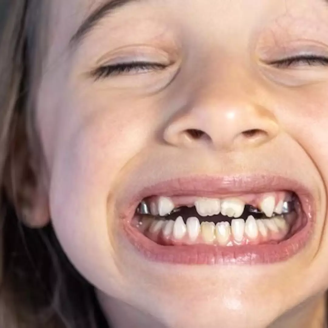 Tak cuma baking soda, ini cara basmi noda kuning agar gigi tak mudah rapuh pakai 1 jenis sampah dapur