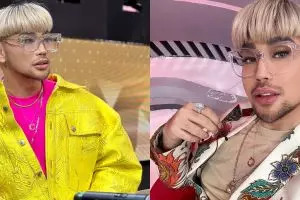 Sempat pamer jalan-jalan dengan wajah bengkak, Caren Delano ungkap alasan oplas bukan untuk penampilan