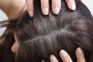 Tak hanya dengan kopi, ini cara menghitamkan rambut uban pakai tambahan 1 jenis kulit bumbu dapur