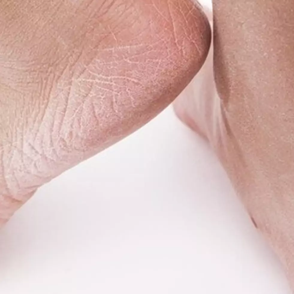 Nggak perlu pakai pelembap, begini cara melembutkan tumit kaki pecah-pecah pakai 1 bahan dapur