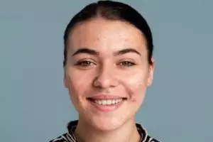 Tanpa kunyit dan lemon, begini trik atasi noda hitam dan kusam pada wajah pakai 2 jenis buah-buahan