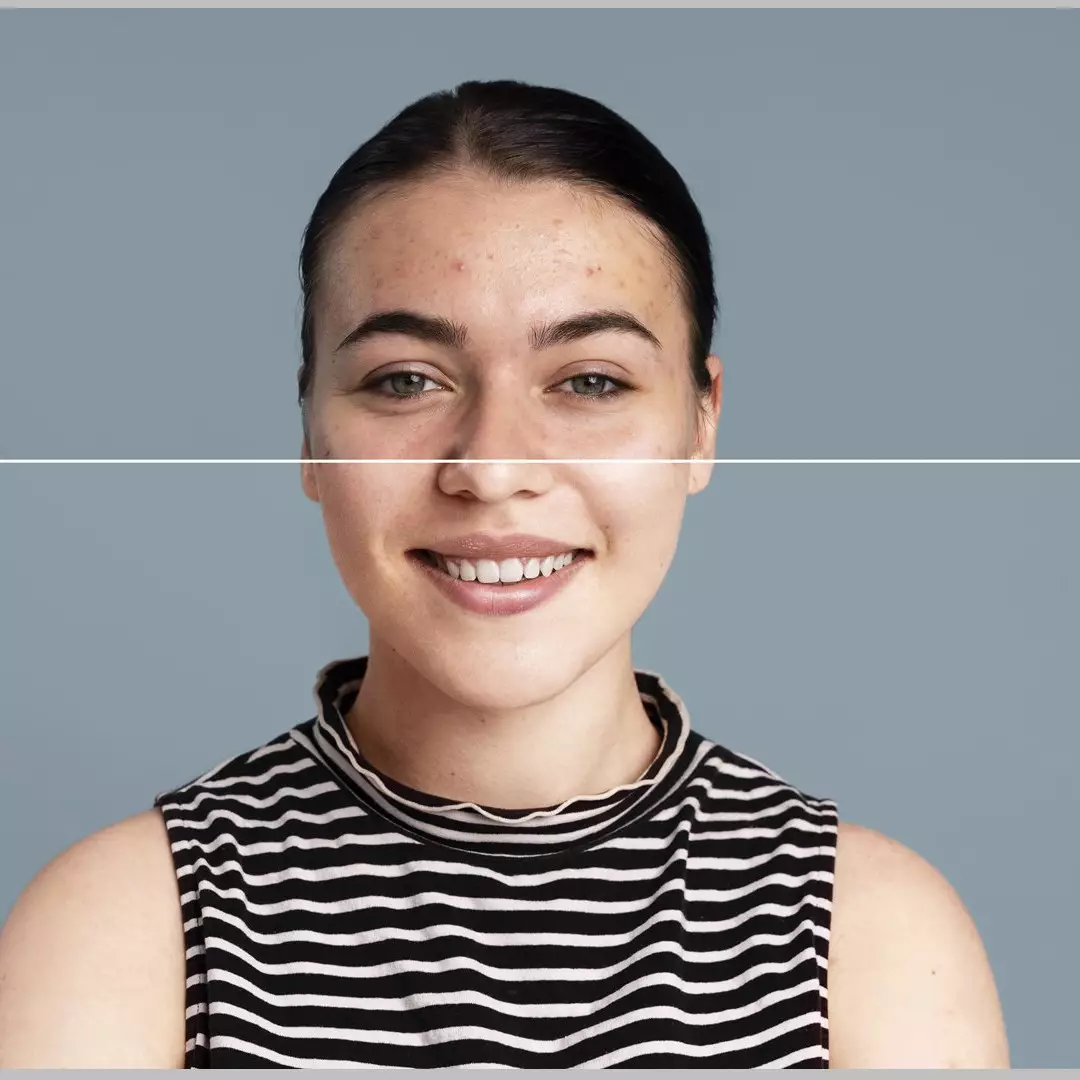 Tak perlu kopi, ini cara menghaluskan kulit kasar gradakan ala wanita Korea pakai 1 bahan makanan