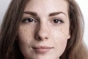 Nggak perlu kunyit dan timun, begini cara pudarkan flek hitam pada wajah dengan 1 jenis tanaman hias