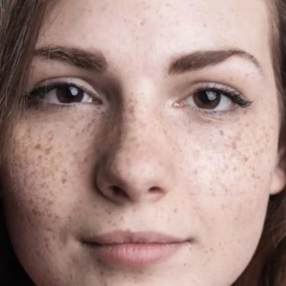 Nggak perlu kunyit dan timun, begini cara pudarkan flek hitam pada wajah dengan 1 jenis tanaman hias