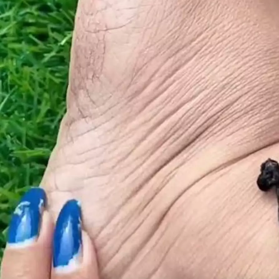 Nggak perlu pakai minyak zaitun, begini cara simpel muluskan tumit kaki retak pakai 1 alat penerangan