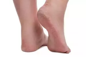 Tanpa madu, ini trik jaga kelembutan tumit kaki agar tak retak menghitam pakai 1 ekstrak kacang