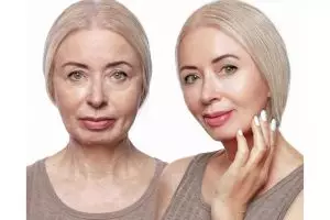 Tak hanya pakai telur, ini trik kencangkan kulit kendur agar tak jadi keriput dengan 1 jenis buah