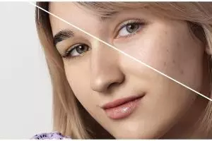 Tanpa kunyit dan lemon, ini trik cerahkan flek hitam di wajah pakai masker dari 1 bahan pemanis