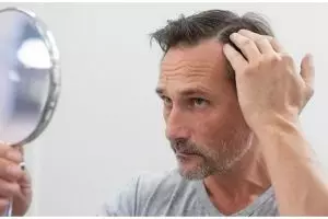 Tak perlu jintan hitam, ini cara menghilangkan uban di usia 20-an pakai hair oil dari 1 jenis tanaman