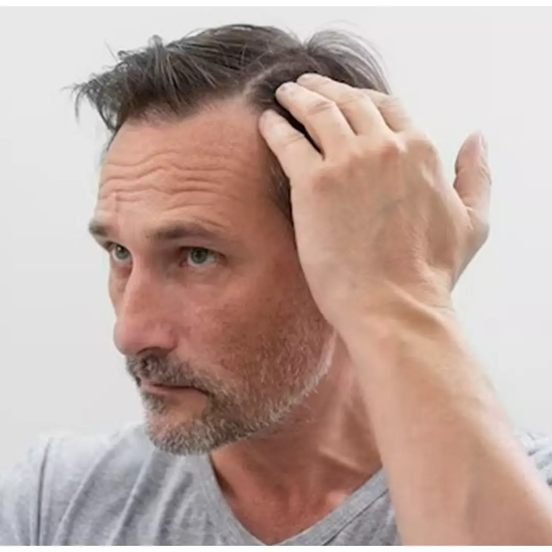 Tak perlu jintan hitam, ini cara menghilangkan uban di usia 20-an pakai hair oil dari 1 jenis tanaman