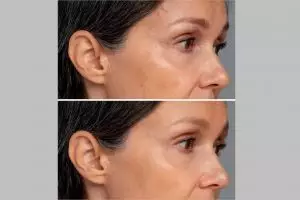 Tak perlu jahe, ini trik simpel pudarkan garis halus di wajah pakai pelembap dari 1 jenis biji buah