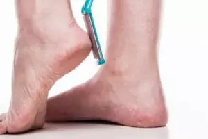 Cara haluskan tumit pecah-pecah cukup pakai 1 kulit buah, autokenyal seperti kulit bayi