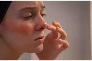 Tanpa madu, ini trik atasi kulit iritasi akibat sunburn pakai masker dari 1 jenis tanah