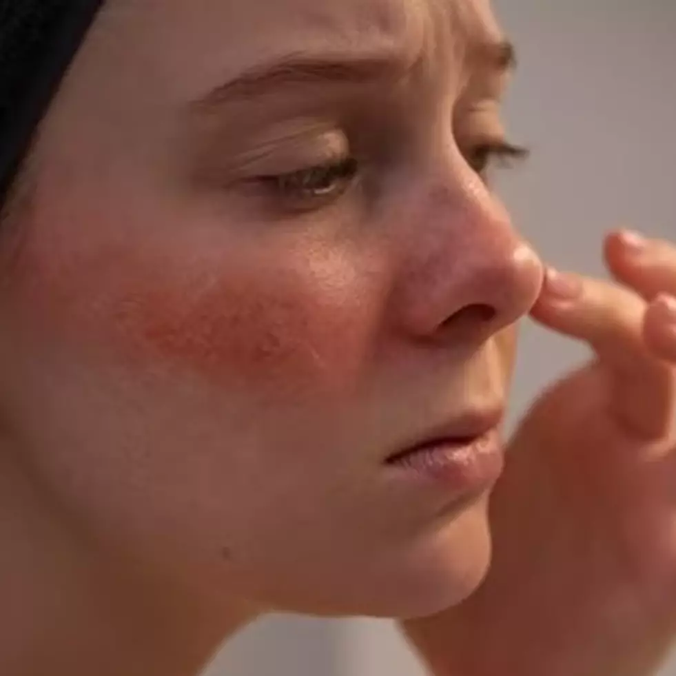 Tanpa madu, ini trik atasi kulit iritasi akibat sunburn pakai masker dari 1 jenis tanah