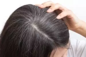 Hitam tanpa jintan dan kopi, ini cara atasi uban dan rambut sulit tumbuh pakai 1 jenis produk bayi