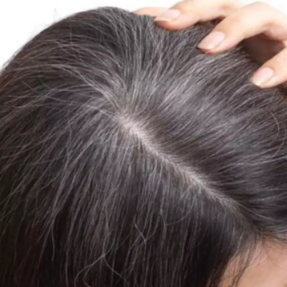 Hitam tanpa jintan dan kopi, ini cara atasi uban dan rambut sulit tumbuh pakai 1 jenis produk bayi