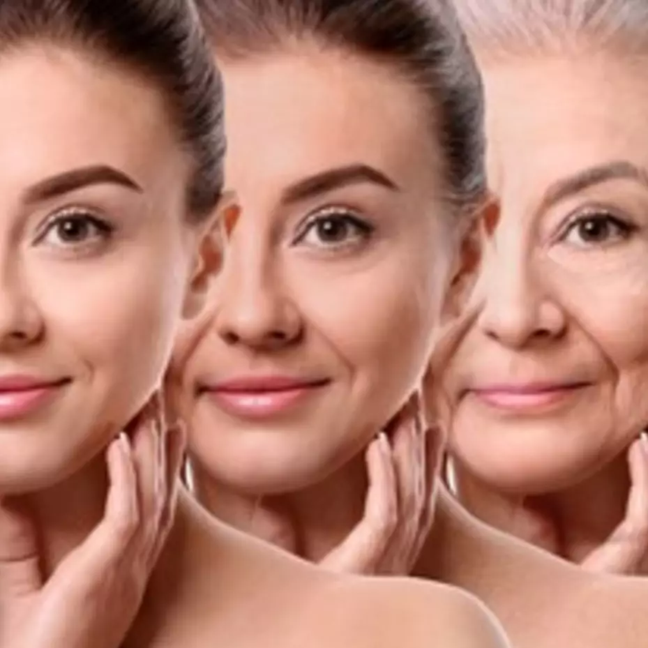 Tak cuma yoghurt, ini trik pudarkan keriput &amp; garis halus di wajah pakai tambahan 1 jenis umbi-umbian