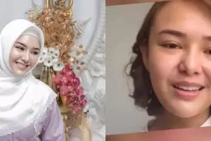 Habiskan Rp 22 juta sekali perawatan, begini 11 pesona Amanda Manopo saat pakai dan tanpa makeup