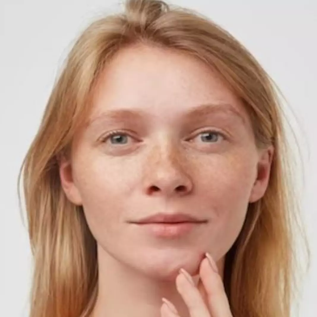 Tak perlu pakai tomat, begini cara pudarkan flek hitam pada wajah hanya dengan 1 jenis olahan susu